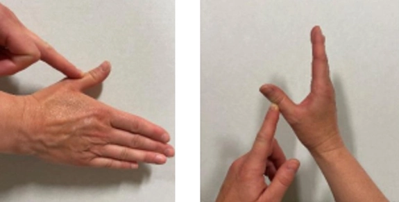 Demonstrations of using index finger on the opposite hand to move thumb up or away from palm